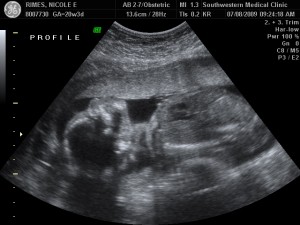 RIMES BABY_21 RIMES BABY_21